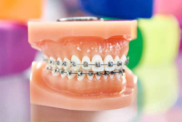 clínica dental Chamberí