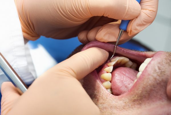 periodoncia en Chamberí