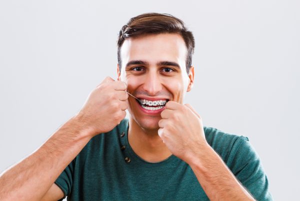 cepillado brackets